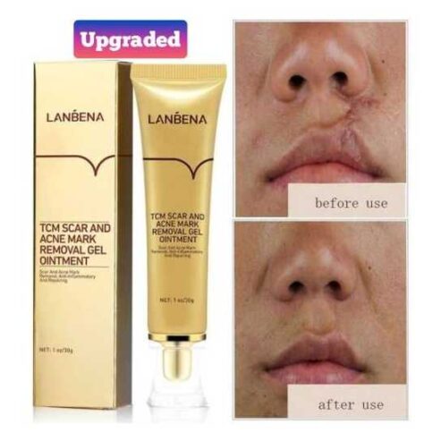 Lanbena scar remover gel